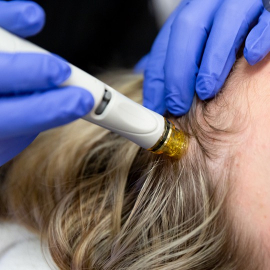 Hydrafacial Keravive Hair Restoration by Modern SLC