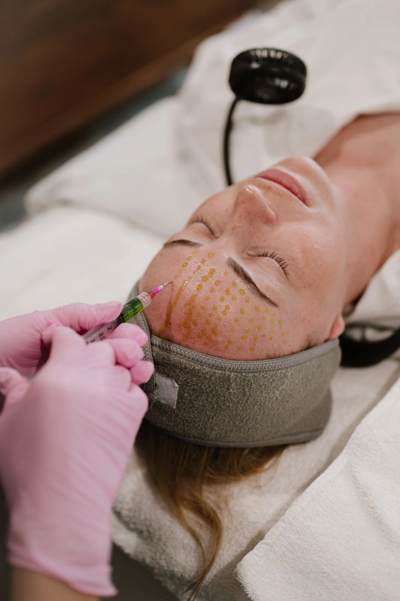 Chemical Peel Treatment in Salt Lake City, UT | Modern SLC