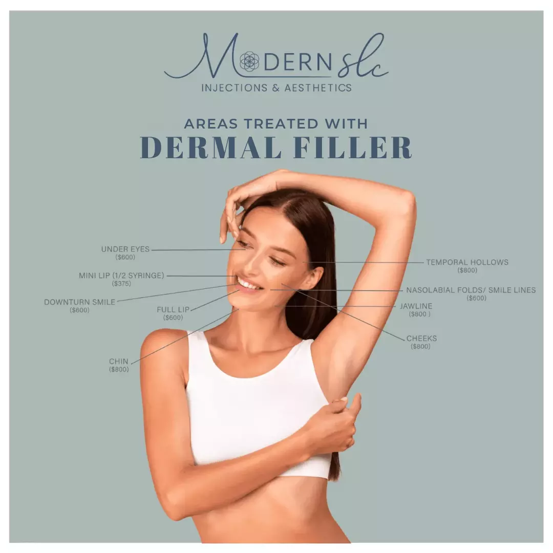 AREAS TREATED WITH DERMAL FILLER in Holladay, Utah | Modern SLC