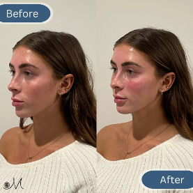 modern-slc-injections-aesthetics-demo-three