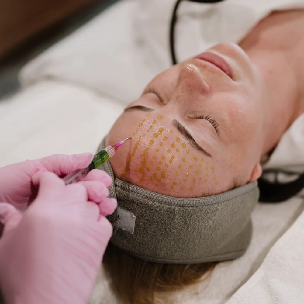 Chemical Peel Treatment in Salt Lake City, UT | Modern SLC