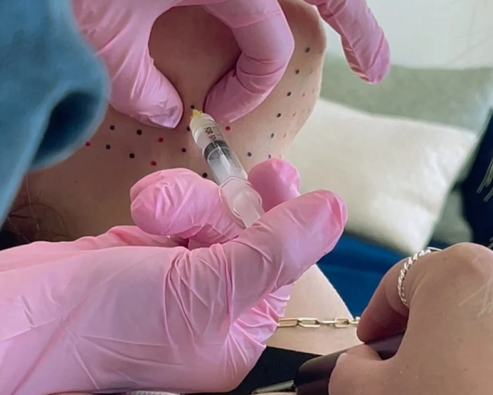 Kybella Treatment in Salt Lake City, UT | Modern SLC