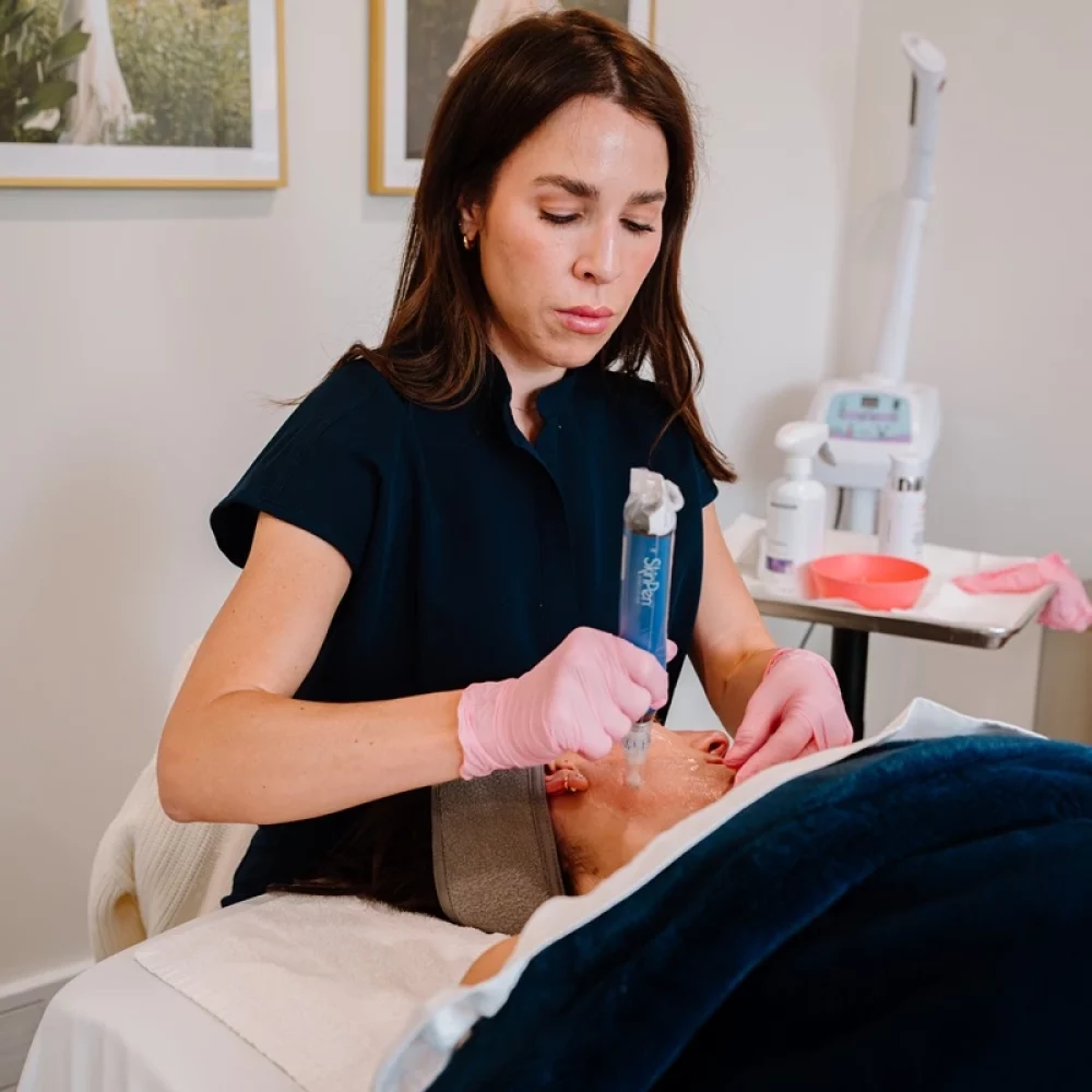 Microneedling Treatment in Salt Lake City, Utah | Modern SLC