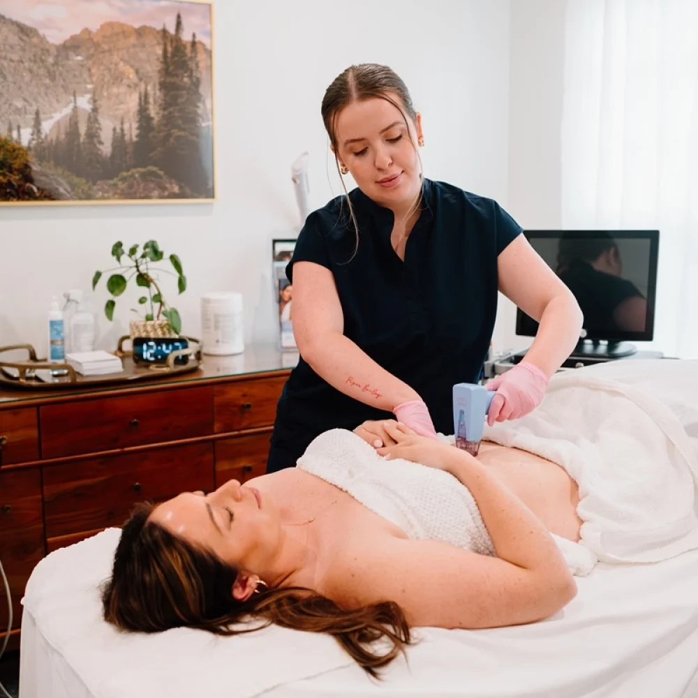 RF Microneedling with the Morpheus8 in Salt Lake City, Utah